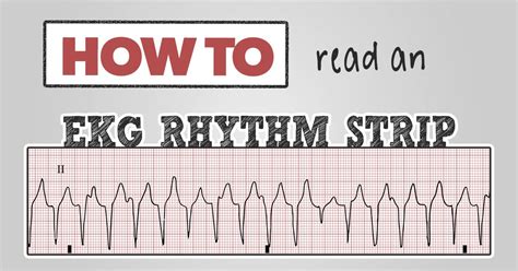 Ekg practice strips. Things To Know About Ekg practice strips. 